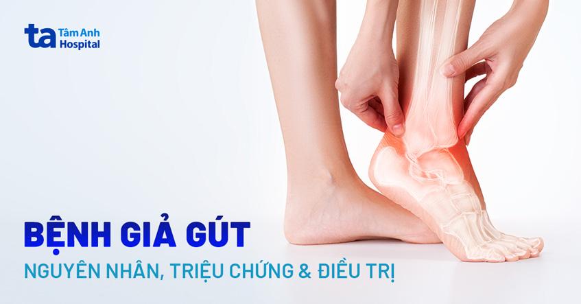 Bệnh giả gout: Nguyên nhân, triệu chứng, điều trị và phòng ngừa