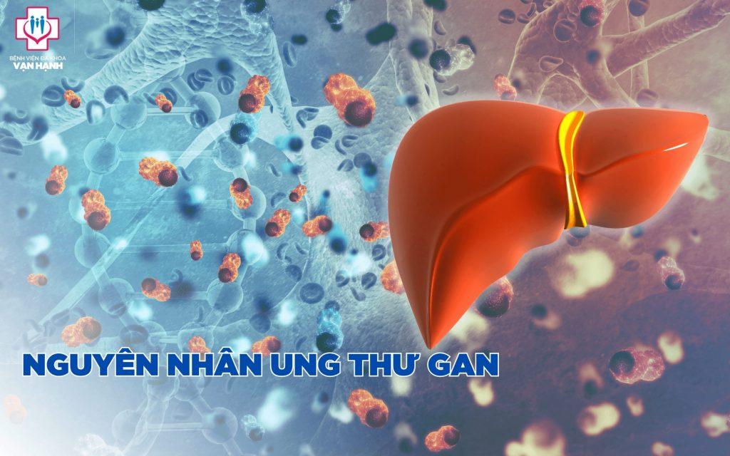 Nguyên nhân gây ung thư gan là gì? - Bệnh viện Đa khoa Vạn Hạnh