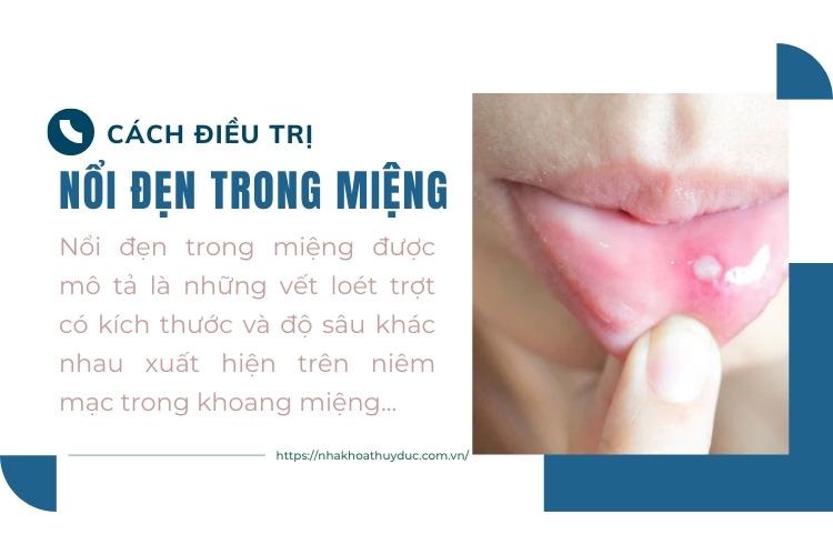 thủy đậu mọc trong miệng