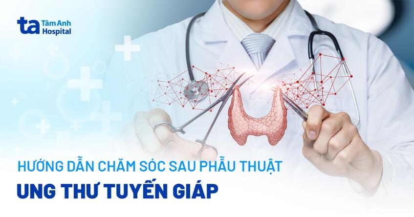 Sau phẫu thuật ung thư tuyến giáp: Hướng dẫn chăm sóc đúng và lưu ý