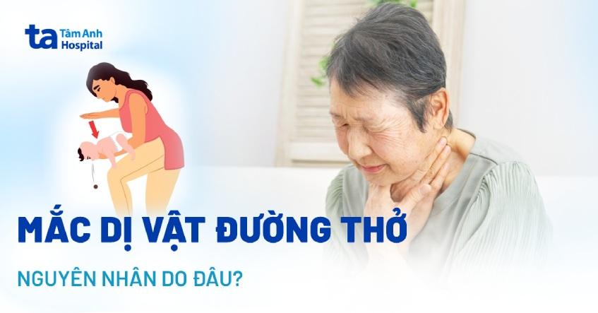 mắc dị vật đường thở